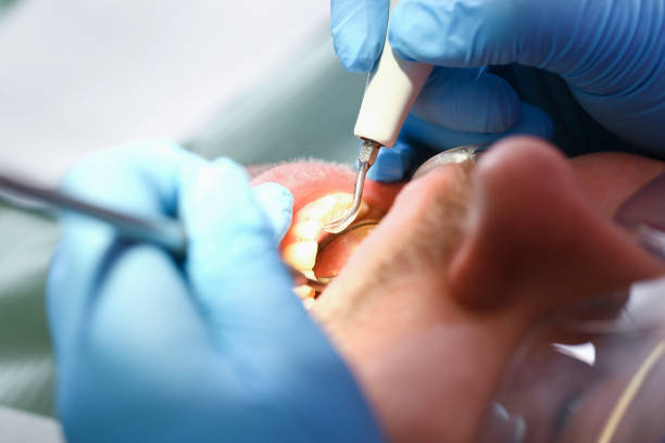 Best Emergency Treatment for Oral Infections in East Douglas, MA