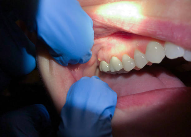 Best Emergency Orthodontic Repairs in East Douglas, MA
